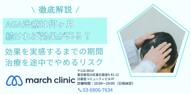 AGA治療 いつまで続ける