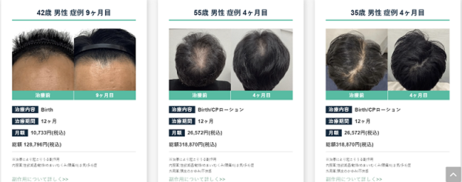 Dr.AGAクリニック 症例写真