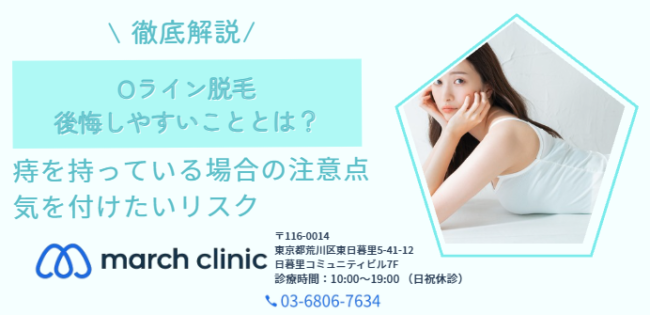 Oライン脱毛 後悔
