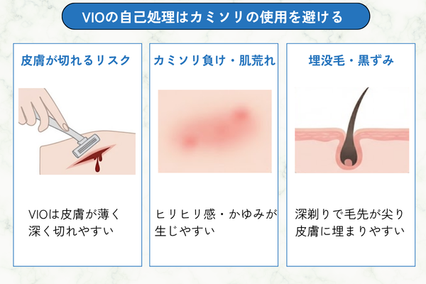 VIOの自己処理はカミソリの使用を避ける