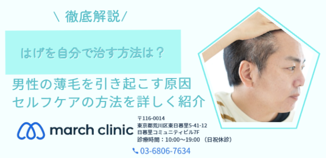 はげ 自分で治す方法 男性