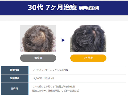 イースト駅前クリニックの症例-1