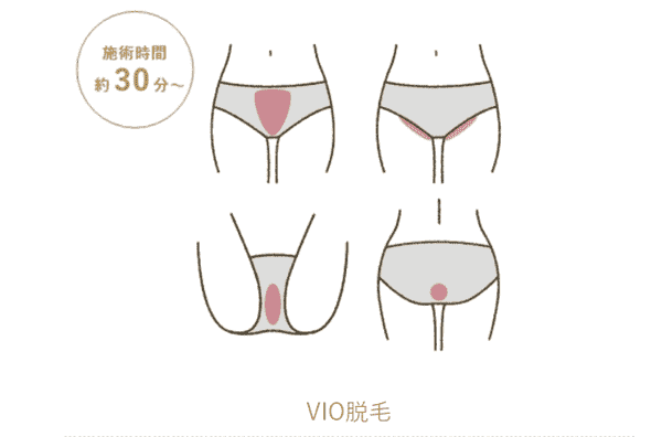 ウィルビークリニック VIO脱毛