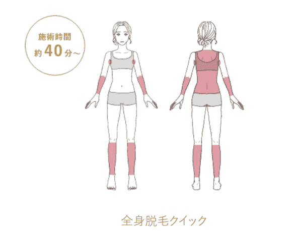 ウィルビークリニック 全身脱毛クイック