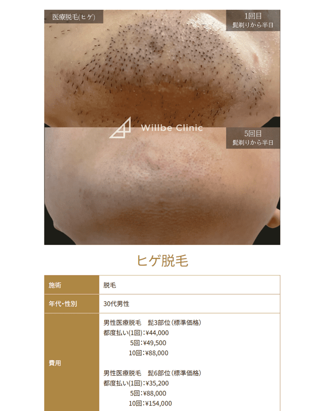 ウィルビークリニックのメンズ医療脱毛の症例