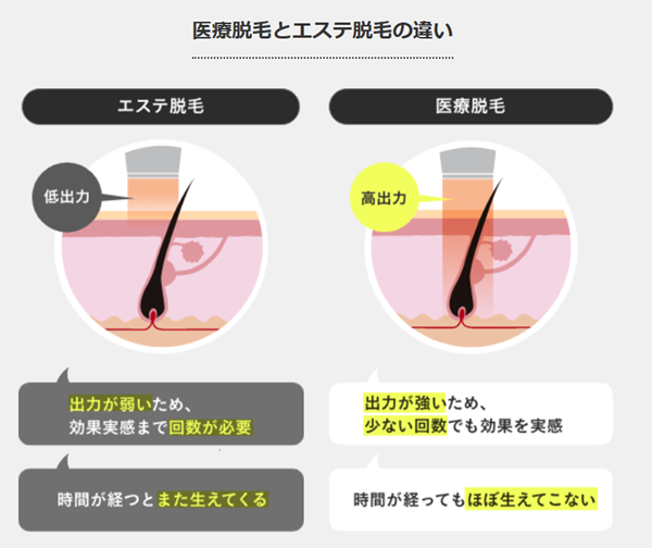 エナミルクリニックメンズ 脱毛図