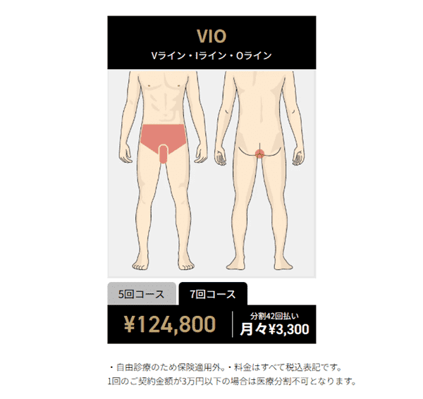 ゴリラクリニックのVIO脱毛