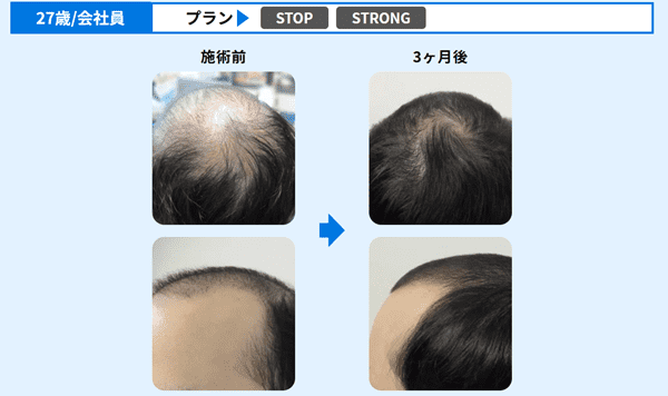 ゴリラクリニックの症例写真