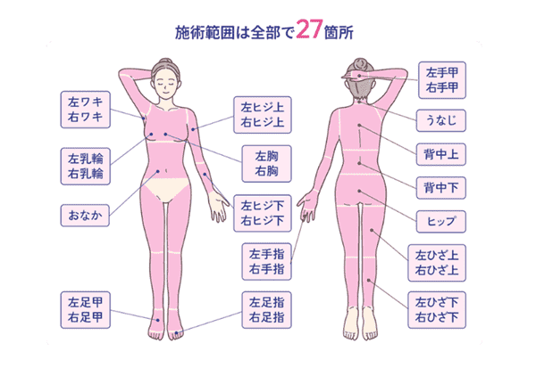 フレイアクリニク全身脱毛