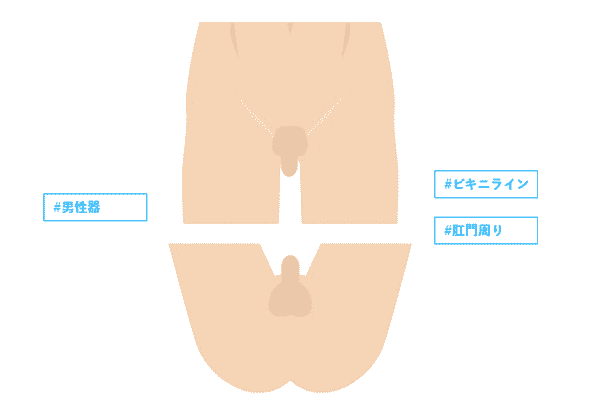 メンズリゼ VIO脱毛