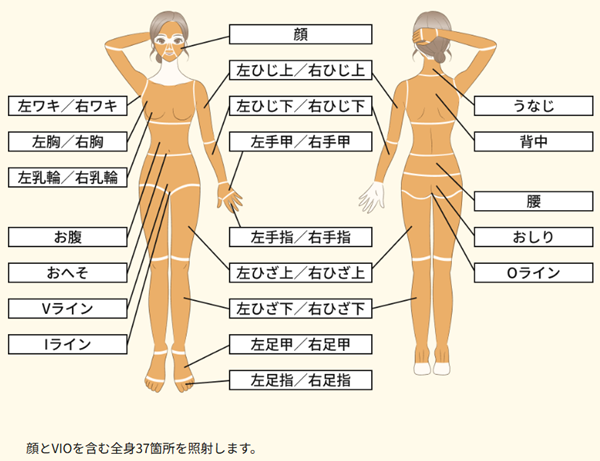 レジーナクリニック オーダーメイドプラン 全身脱毛+VIO+顔