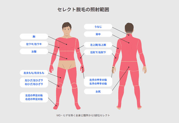 レジーナクリニックオム セレクト脱毛の照射範囲