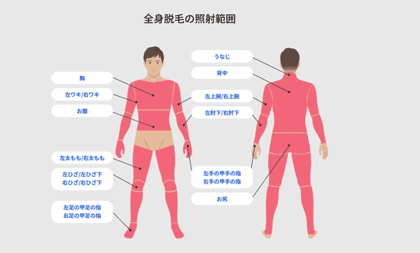 レジーナクリニックオム 全身脱毛の照射範囲