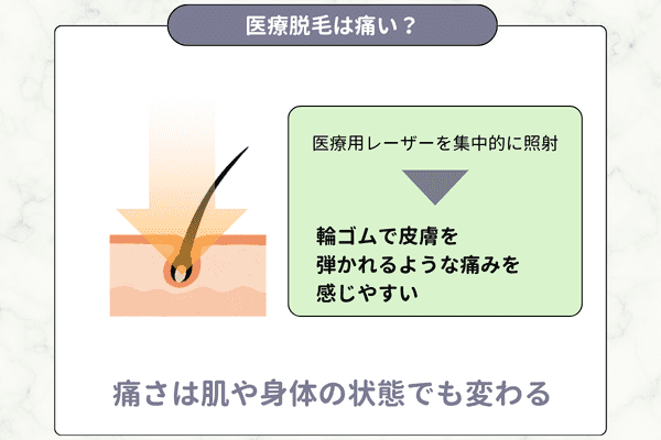 医療脱毛は痛い？