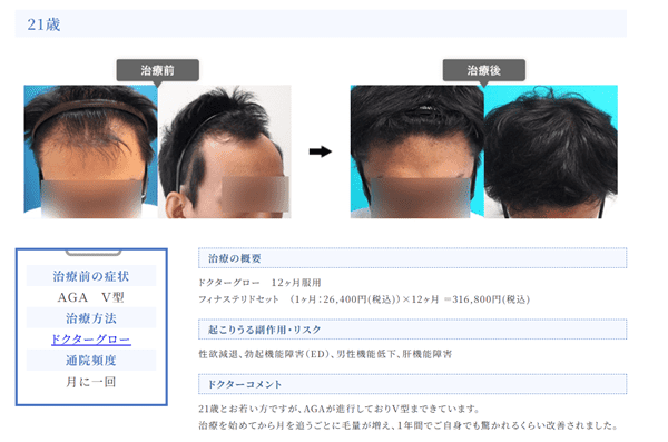 大西美容形成クリニックの症例写真