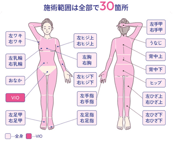 安心プラン 全身脱毛+VIOの料金