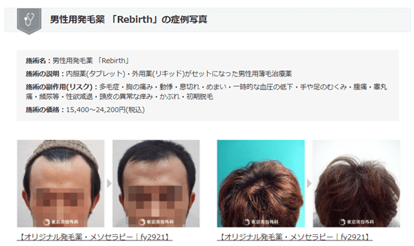 東京美容外科青森院の症例写真