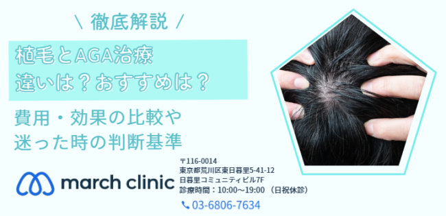 植毛 AGA治療 違い