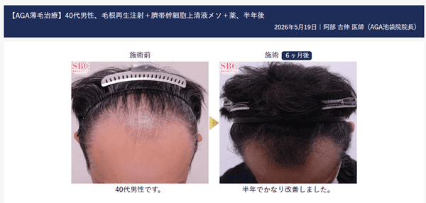 湘南美容クリニックのAGA症例写真