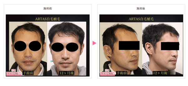 湘南美容クリニック 秋田院の症例写真