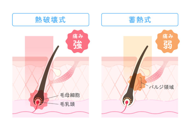 熱破壊式・蓄熱式【図解】