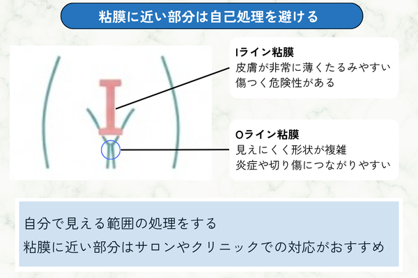 粘膜に近い部分は自己処理を避ける